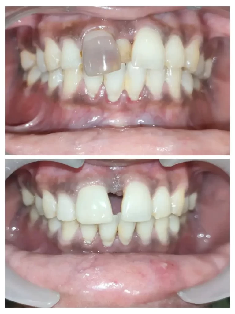 Best Dental Clinic in Chennai