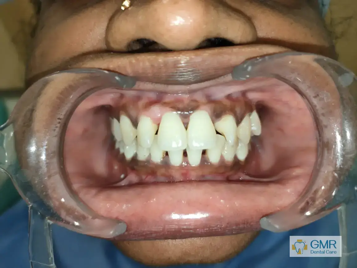 Orthodontist in Egmore